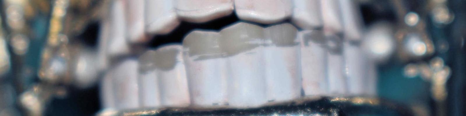 Seams on Teeth