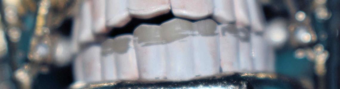 Seams on Teeth